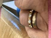 Lost the eternity ring in the picture. It was given to me by the husband of a ve