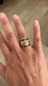Ring lost in carpark of estate on Northwold road near Tower Theatre. Please help